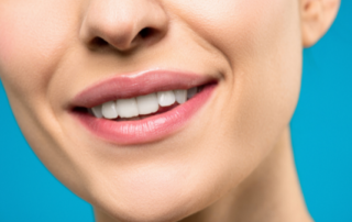 Gafencu Beauty Wellness DIY teeth whitening oral hygiene teeth cleaning natural organic oral care